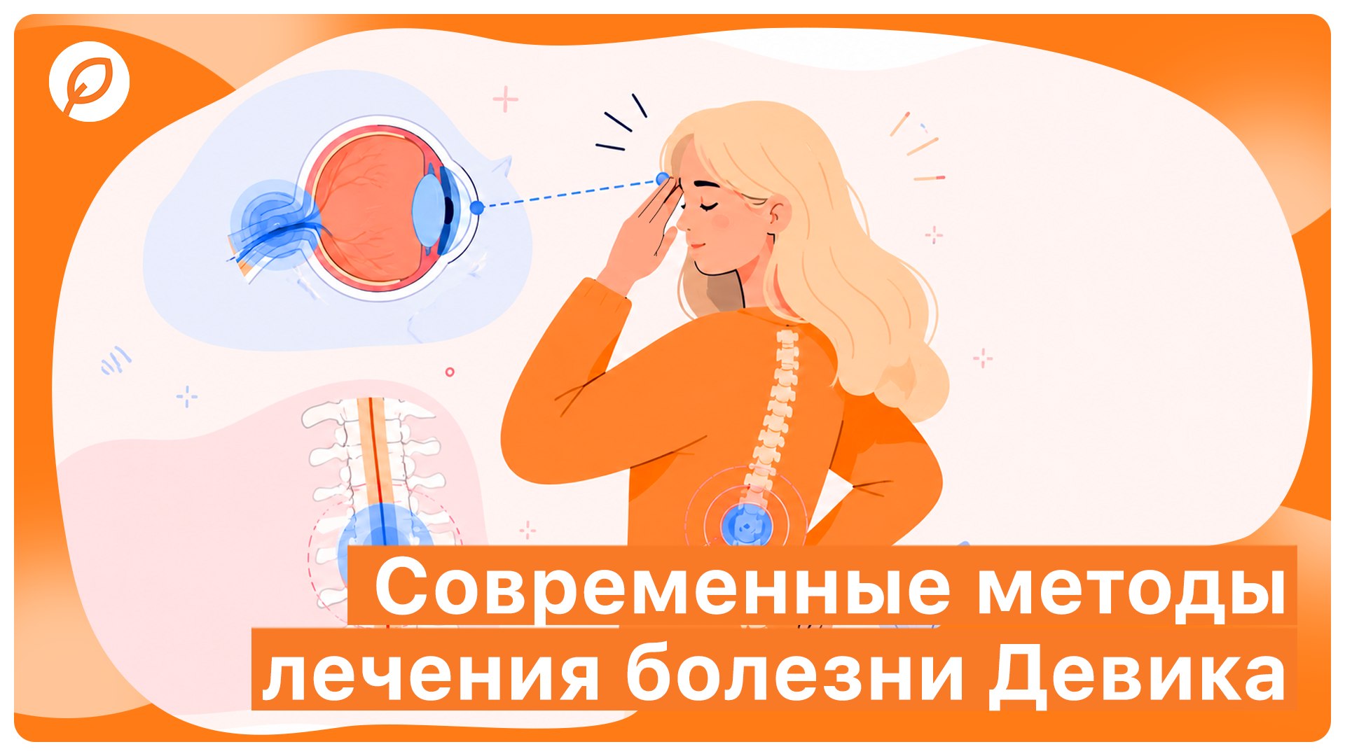 Betalife — рассеянный склероз и оптиконевромиелит. Полезные советы и статьи от медэкспертов