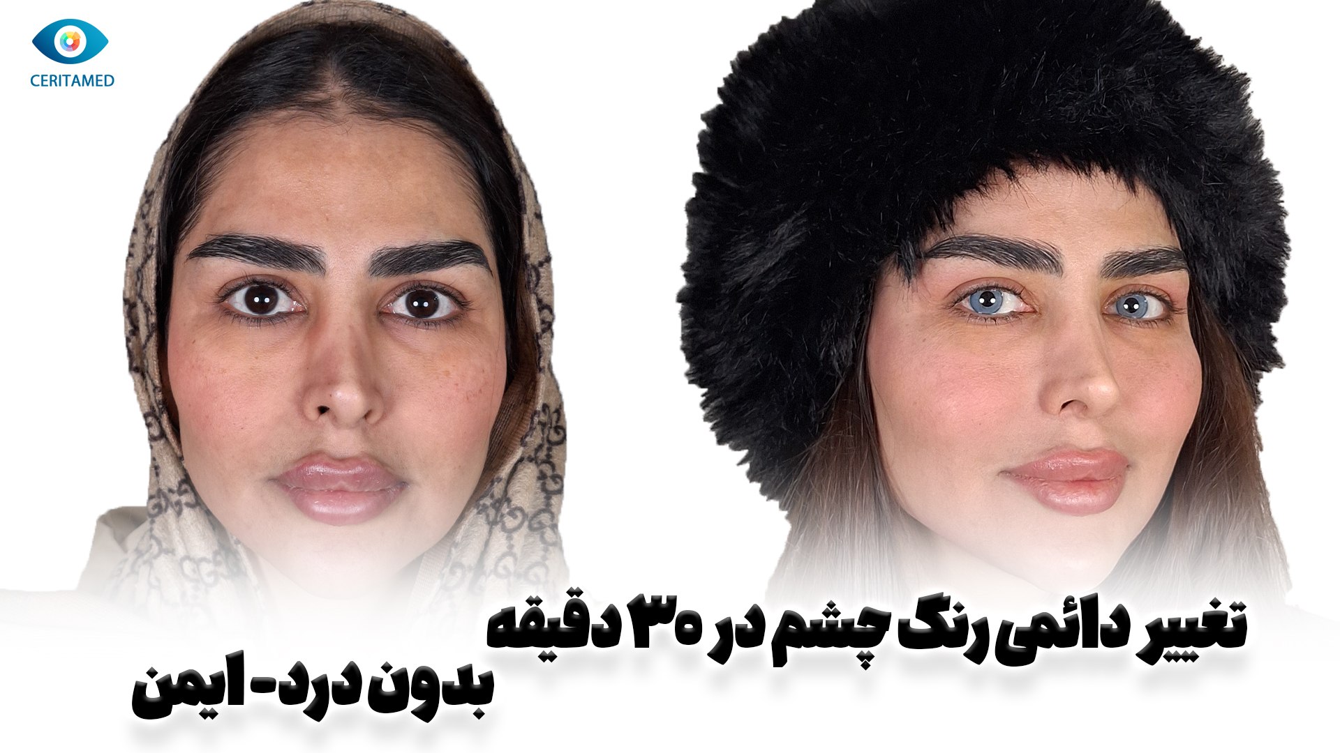 مرکز تخصصی تغییر رنگ چشم رویال (سریتامد)